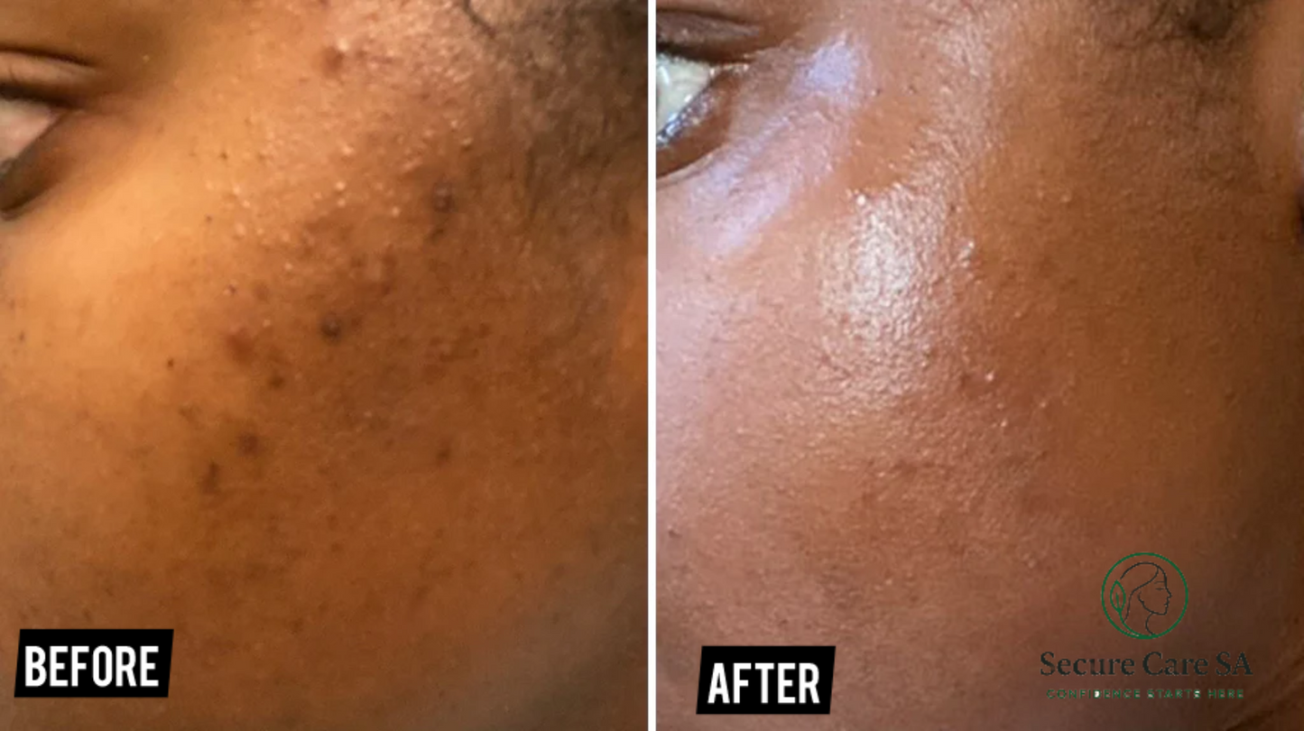 Axis y Dark Spot correcting serum