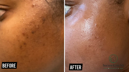 Axis y Dark Spot correcting serum